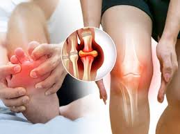 These symptoms indicate that Uric Acid has increased in the body