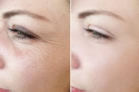 2 pranayams reduce wrinkles and brighten the skin
