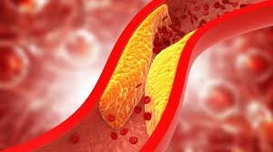 Nowadays most people are suffering from high cholesterol problem