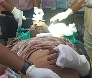 Injured old man dies in Kurnoor Koyta attack