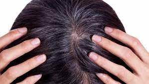 remedies to stop hair loss