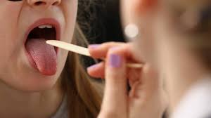 How do doctors predict diseases by looking at the tongue